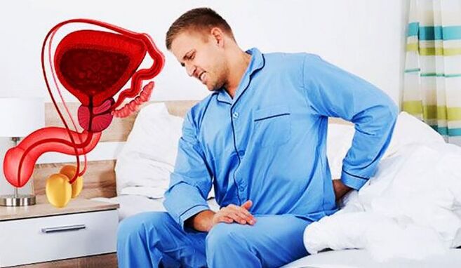 sāpes muguras lejasdaļā prostatīta dēļ