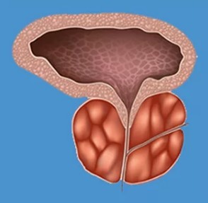 Raksturīgās pazīmes prostatīta