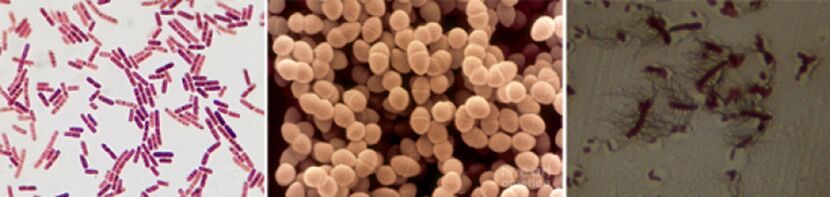 E. coli, fekāliju enterokoks un proteus ir galvenie hroniskā bakteriālā prostatīta izraisītāji